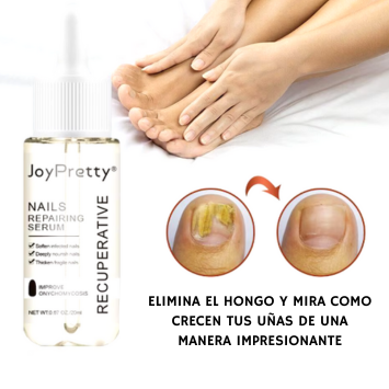 💅🏻☘️SERUM PARA CRECIMIENTO DE UÑAS 💅🏻☘️ NAIL GROWTH OIL🪔