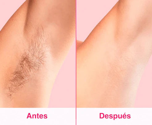 ✨💃🏻Depiladora Láser IPL Permanente💃🏻✨