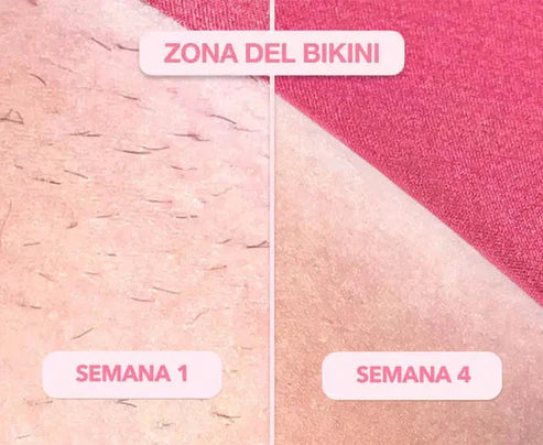 ✨💃🏻Depiladora Láser IPL Permanente💃🏻✨